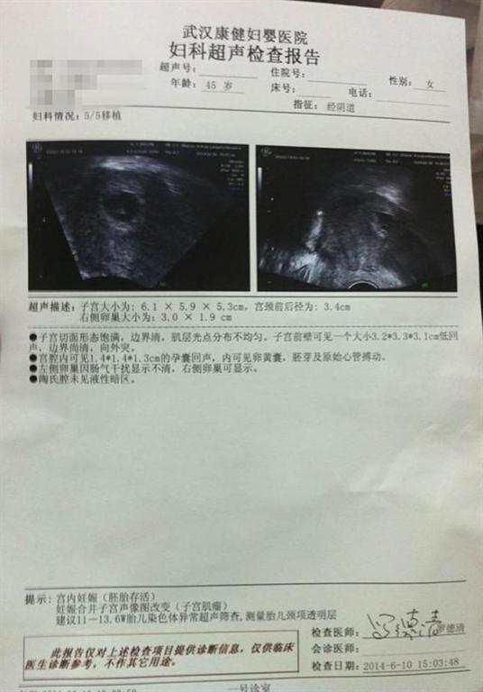 奇闻轶事血精症不可怕!试管大胖小子抱回家