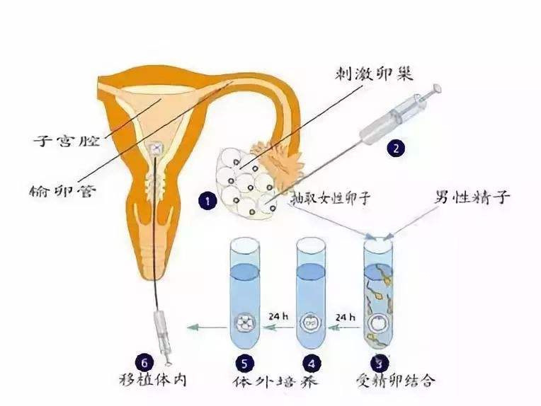 2024年广州精子库提供的精子助孕机构咨询电话费用是多少