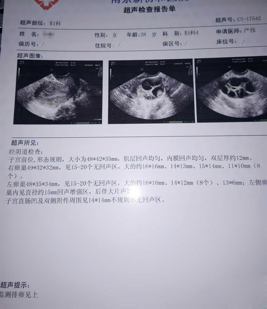备孕要怎么进行补充维生素（备孕吃维生素的推荐快来看看吧!）