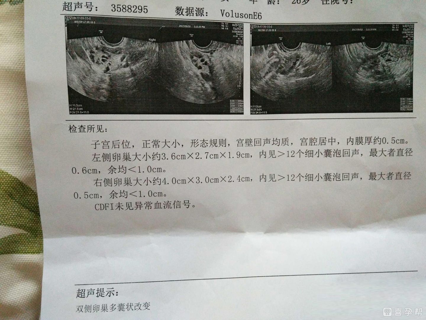单精子注射是什么意思（单精子注射技术可以选择xy吗）