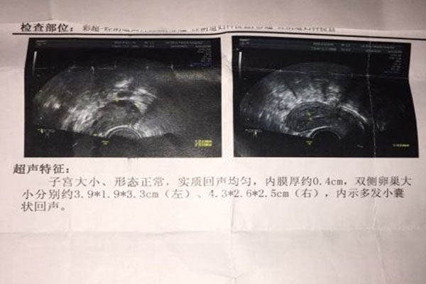高龄女性依靠供卵代怀套餐技术追生“二胎”